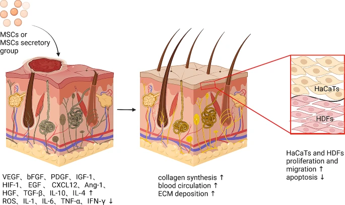 图5：间充质干细胞促进皮肤创面愈合的机制。