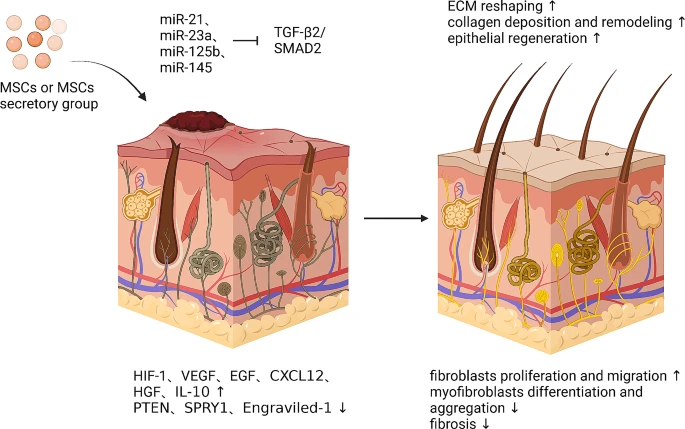 图6：间充质干细胞促进皮肤疤痕修复的机制。