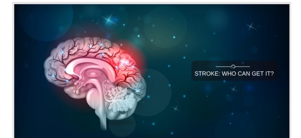 中风的症状和体征是什么-哪些人容易患中风？