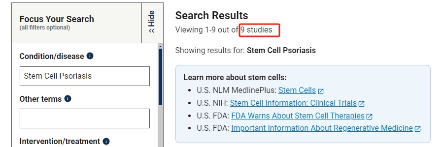 干细胞治疗银屑病的临床研究进展