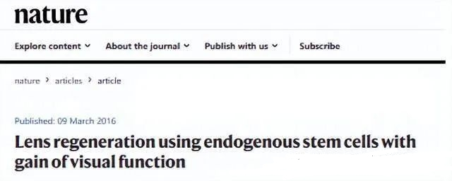 干细胞治疗儿童白内障临床案例 干细胞治疗儿童白内障临床案例