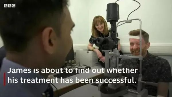 干细胞治疗烧伤失明临床案例 干细胞治疗烧伤失明临床案例