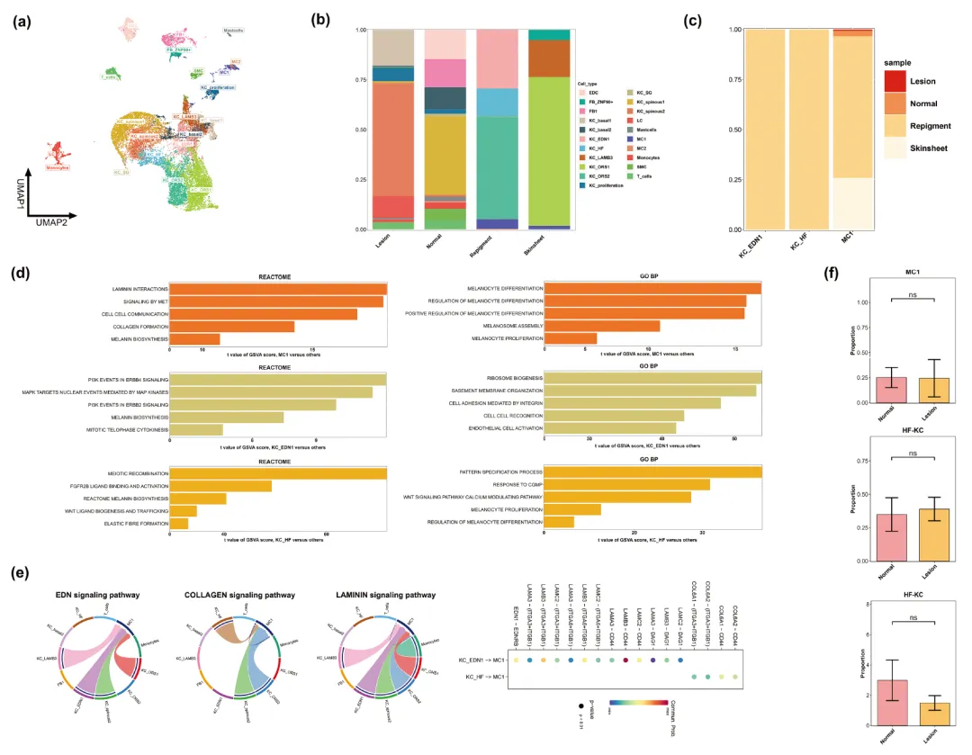 2024年干细胞治疗白癜风临床案例 2024年干细胞治疗白癜风临床案例