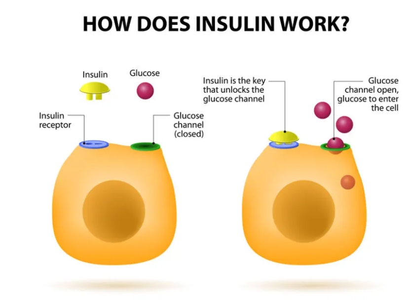 1型糖尿病的胰岛素治疗方案：类型与注射技巧