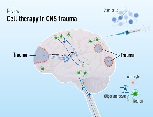 干细胞疗法修复中枢神经系统创伤:4个原则—什么、何时、何地和为什么 干细胞疗法修复中枢神经系统创伤:4个原则—什么、何时、何地和为什么