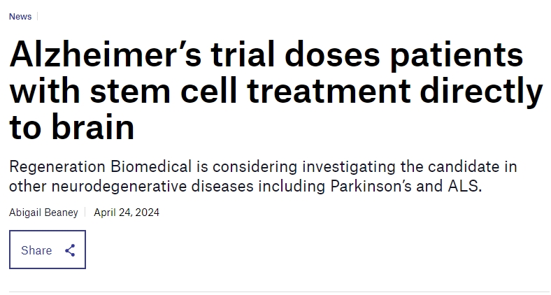 阿尔茨海默氏症试验将干细胞直接注入患者大脑