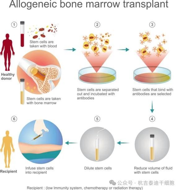 干细胞移植治疗需要多长时间？