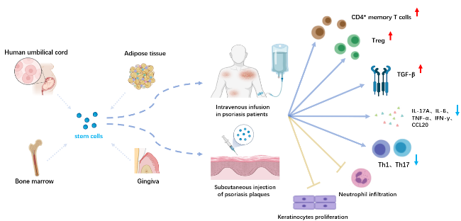 图1：干细胞在牛皮癣治疗中的应用