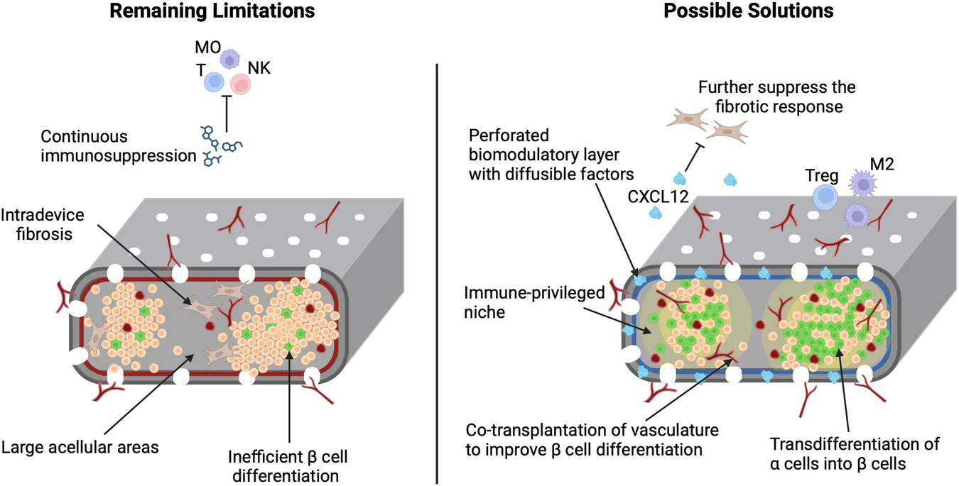 图2：增加功能性β细胞质量和消除全身免疫抑制的策略
