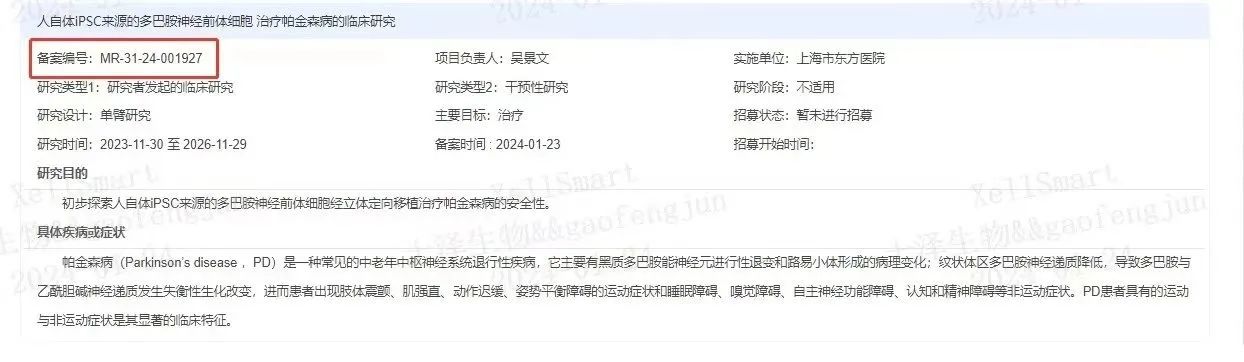 临床级iPSC衍生多巴胺能神经前体细胞治疗帕金森病的临床研究