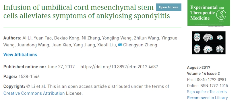 输注脐带间充质干细胞可缓解强直性脊柱炎症状