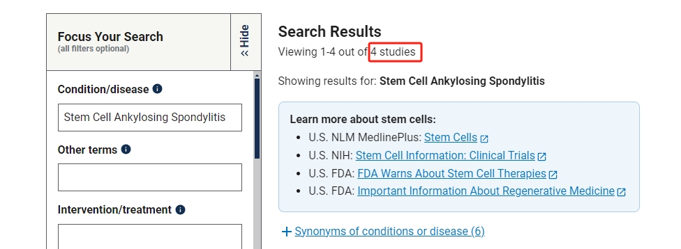 干细胞治疗强直性脊柱炎临床研究项目有4项