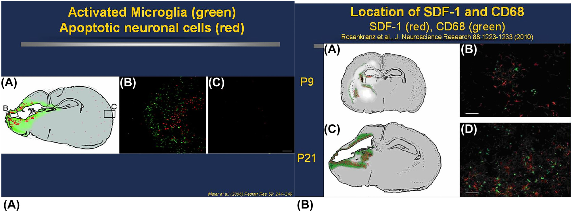 新生大鼠PN9和 PN21 HI后激活的小胶质细胞和SDF-1表达