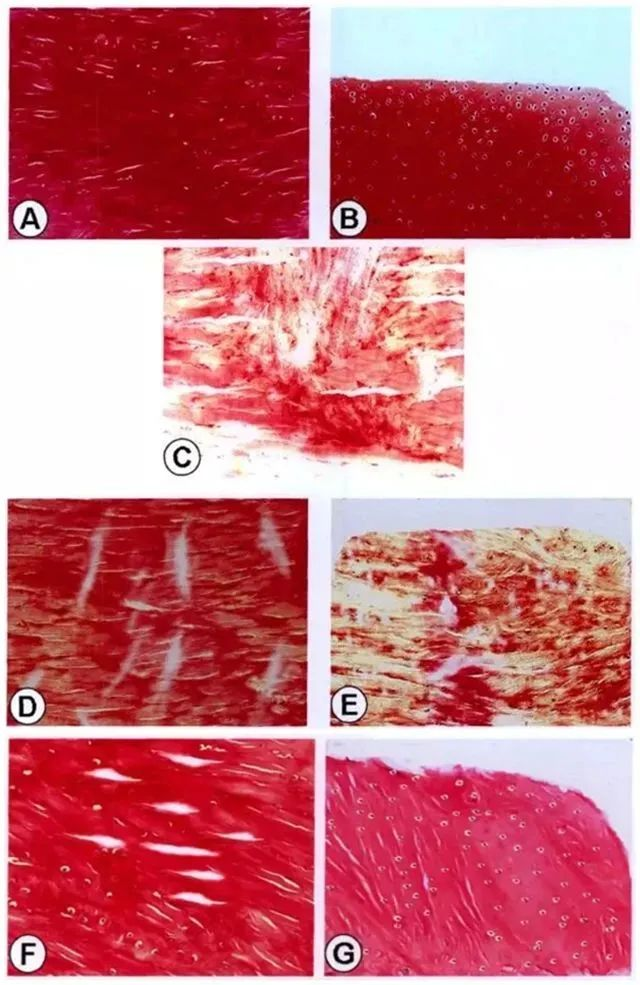 不同时间点修复组织红-红区与白-白区II型胶原表达量
