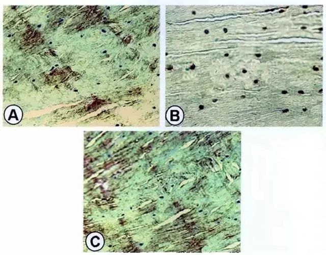 A为红-红区修复组织II型胶原的表达；B为红-红区修复组织S-100蛋白表达；C为红-红区修复组织I型胶原表达。