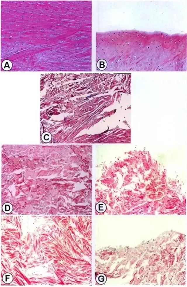 不同时间点修复组织红-红区与白-白区II型胶原表达量
