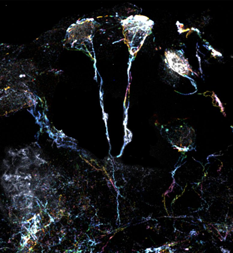 果蝇大脑中处于休眠状态的神经干细胞具有富含肌动蛋白丝的突起 果蝇大脑中处于休眠状态的神经干细胞具有富含肌动蛋白丝的突起