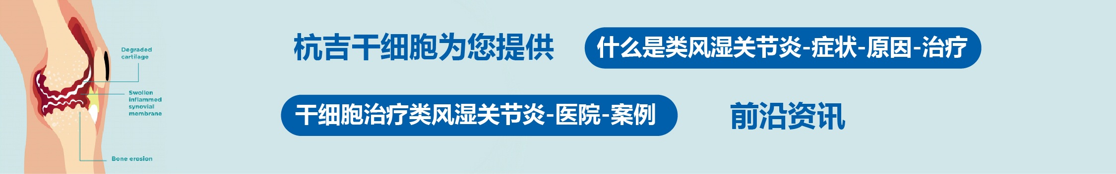国内外干细胞医院治疗类风湿关节炎的临床案例