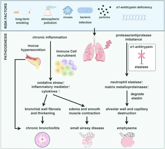 图1：慢性阻塞性肺疾病的风险因素和发病机制。