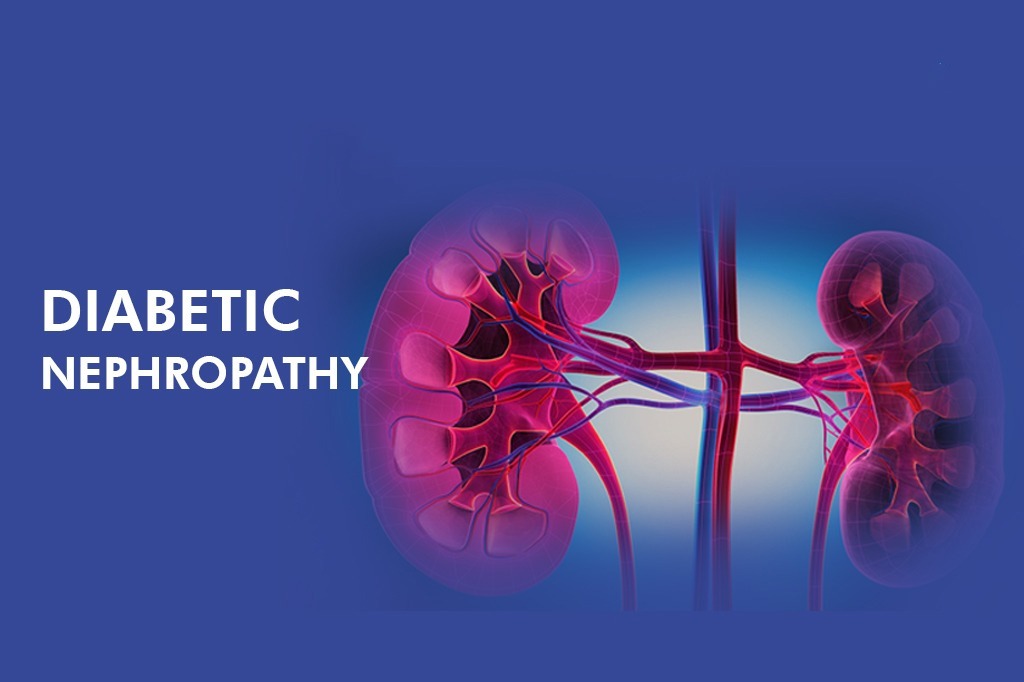干细胞治疗糖尿病肾病患者16例,能够有效控制血糖,改善肾功能 干细胞治疗糖尿病肾病患者16例,能够有效控制血糖,改善肾功能