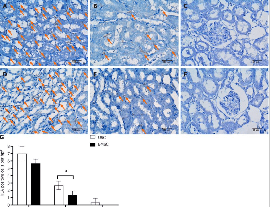 图5：通过人类白细胞抗原免疫染色检测急性肾损伤小鼠肾脏内的尿液干细胞或骨髓间充质干细胞