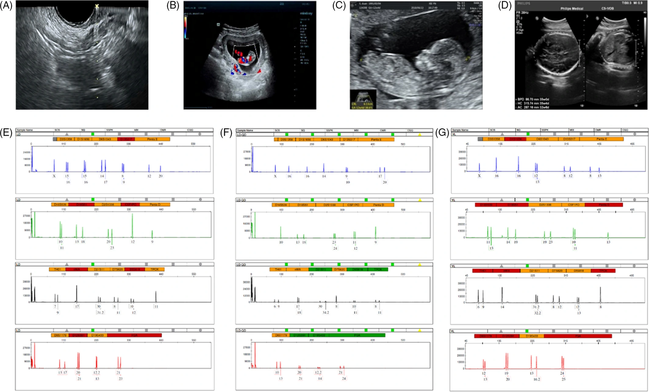 图3：妊娠和新生儿结局