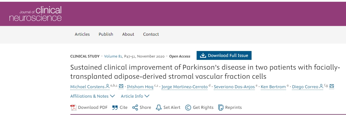 面部移植间充质干细胞治疗2例帕金森病患者，患者临床症状持续改善