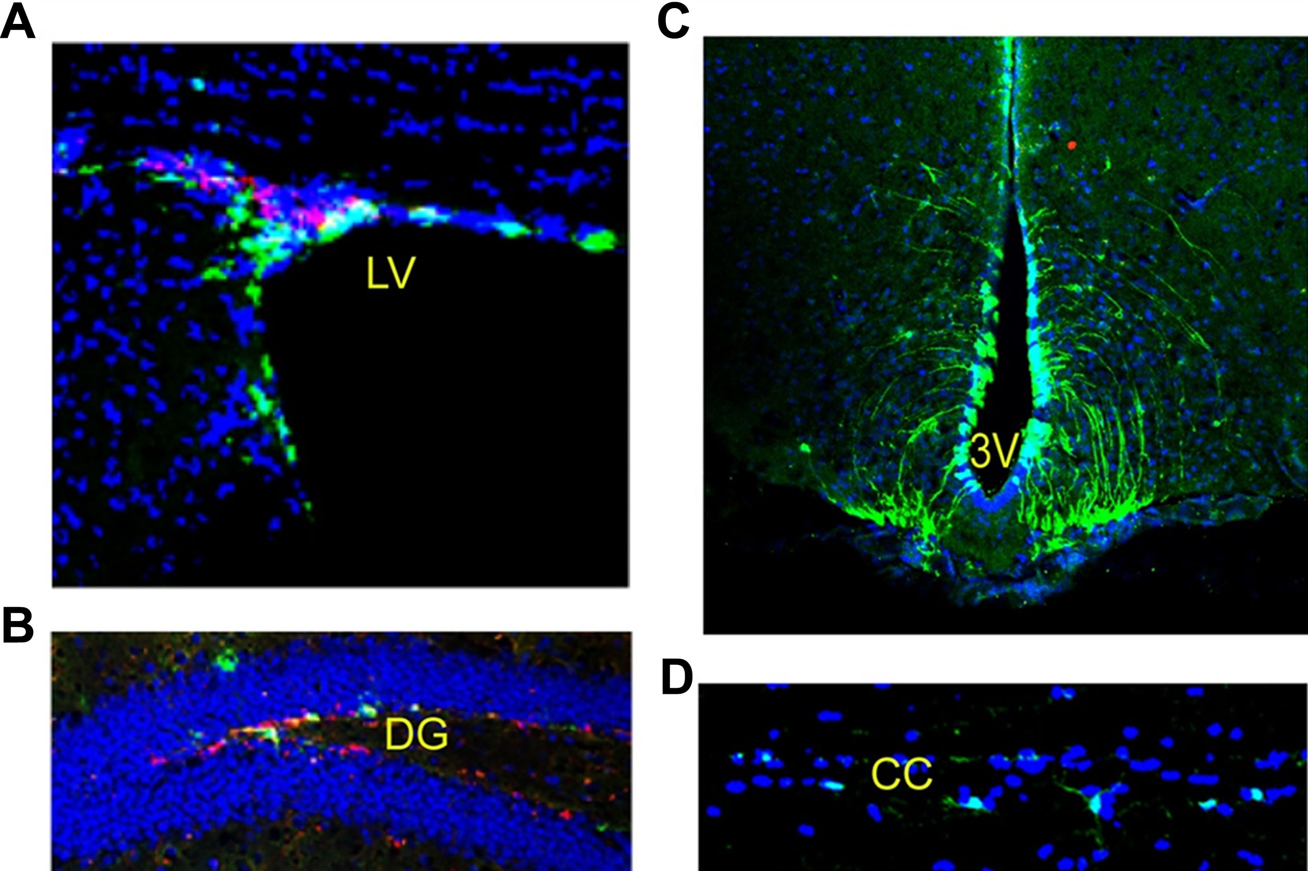 图2：成年小鼠脑和脊髓中的神经干细胞：左脑 (LV)、第三脑室 (DG)、齿状回 (DG) 和脊髓。