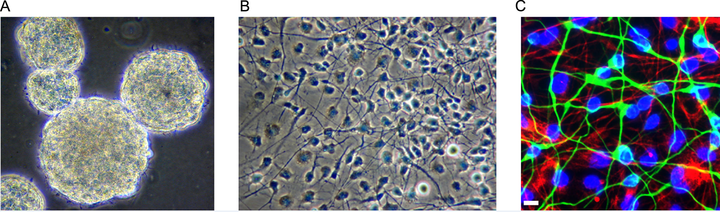 图1：人类胎儿脑源性神经干细胞。