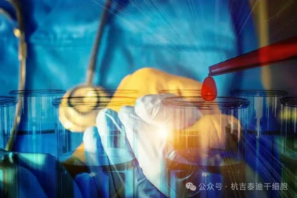 一名RA/MS患者经过CAR-T治疗失败后，经过自体干细胞移植后，主观健康状态显著改善！