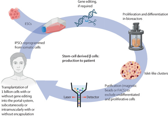 胚胎干细胞或诱导多能干细胞来源的β细胞的制备和移植