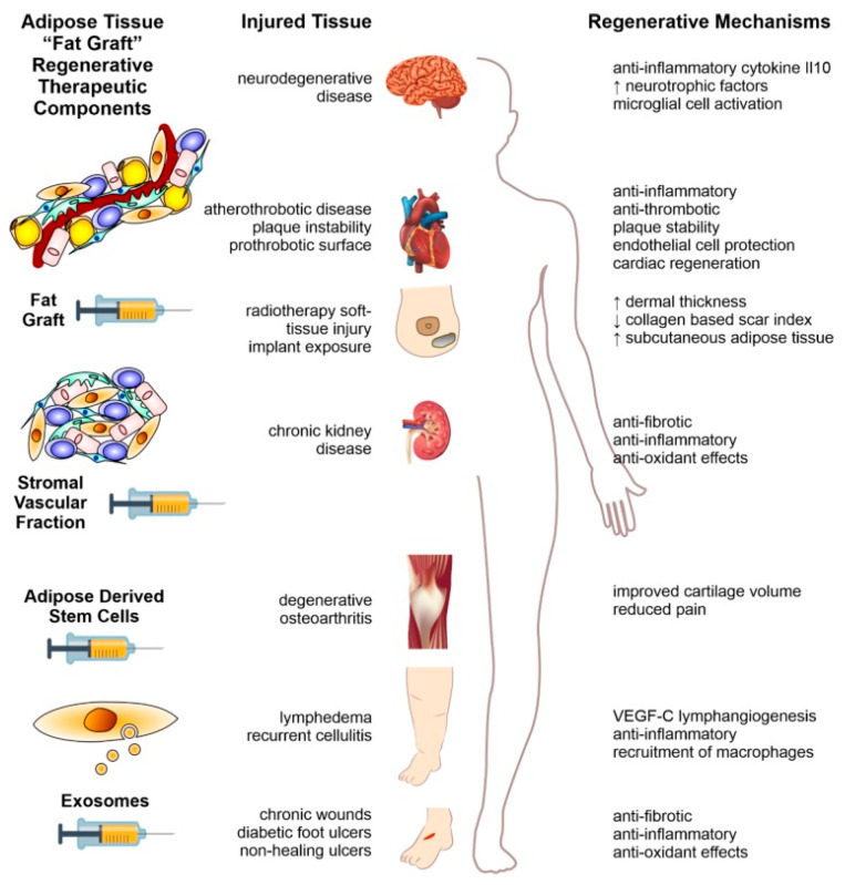 图2：本文以示意图形式概述了利用脂肪组织脂肪治疗人类疾病的方法。