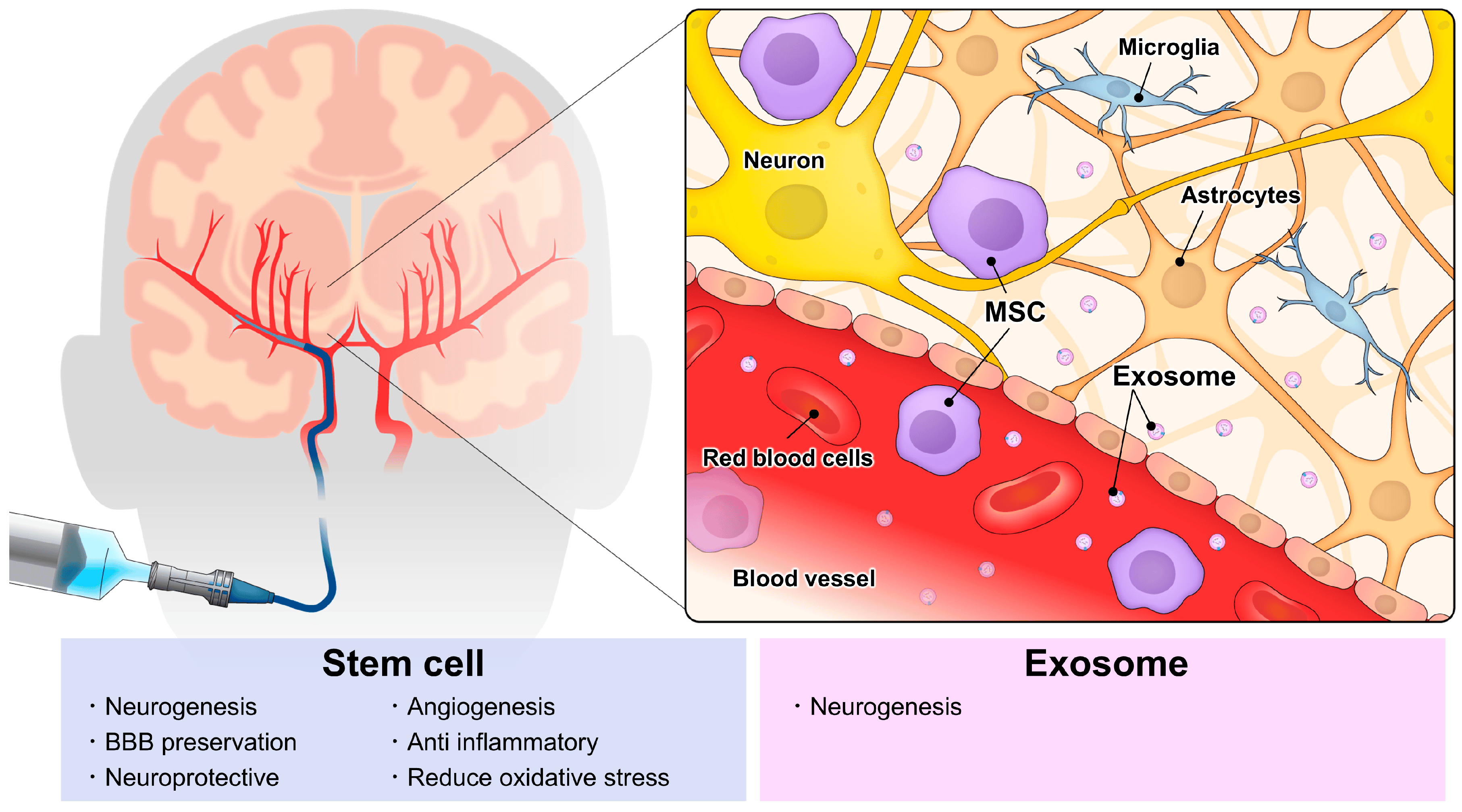 动脉注射干细胞&外泌体治疗神经系统疾病，打多少细胞好？