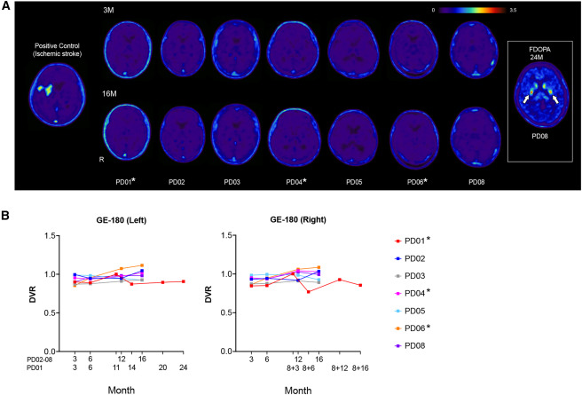 图2：移植对象和对照对象的[18F]GE180PET扫描结果