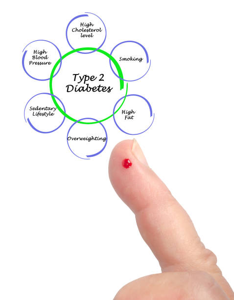哪些人适合干细胞治疗2型糖尿病？专家公布5大评估标准