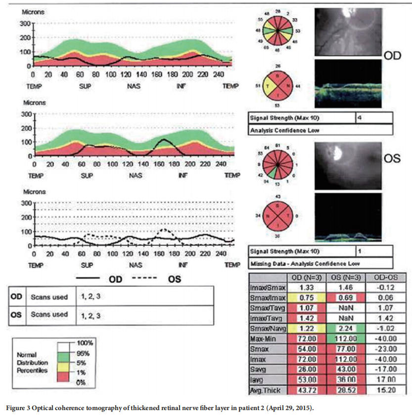 遗传性视神经病变临床试验