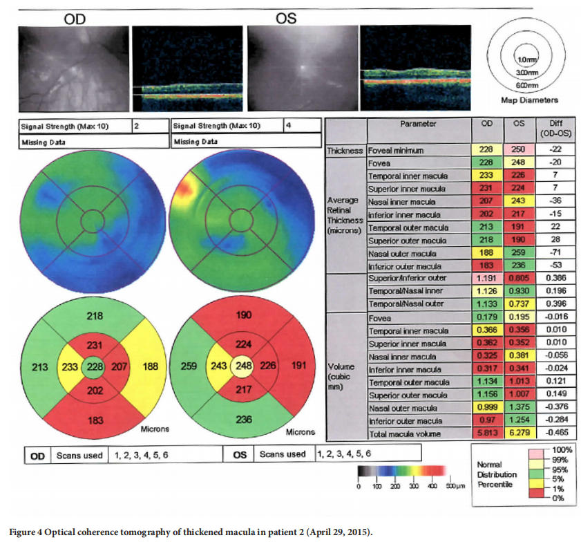 遗传性视神经病变临床试验