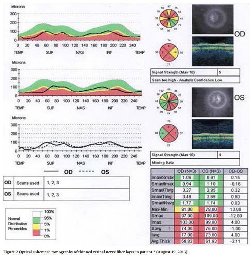 遗传性视神经病变临床试验