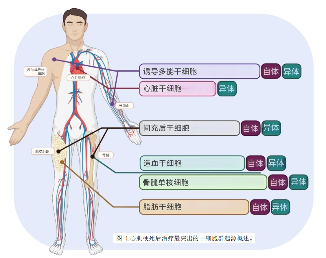 干细胞治疗心梗