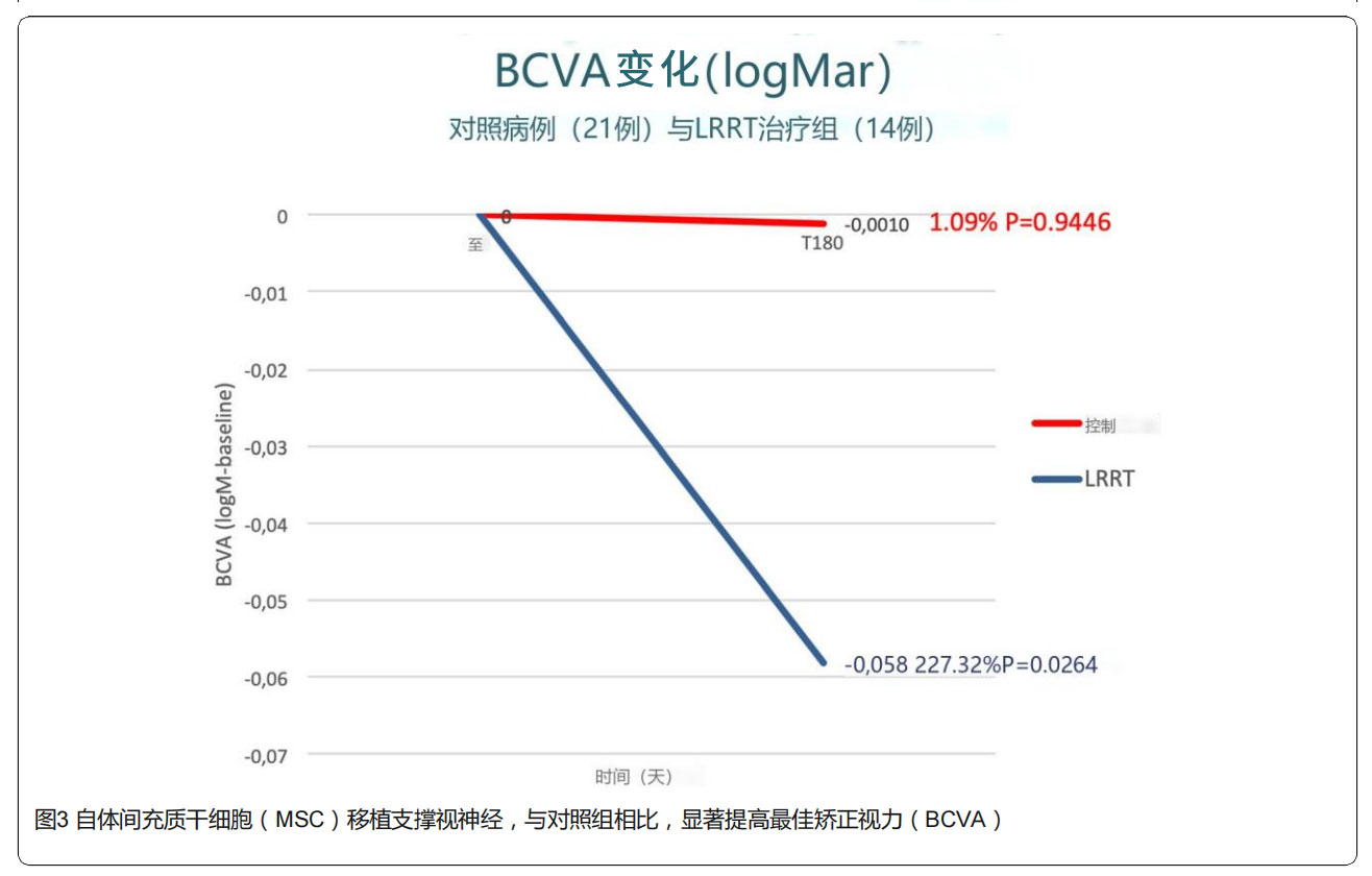 青光眼临床试验