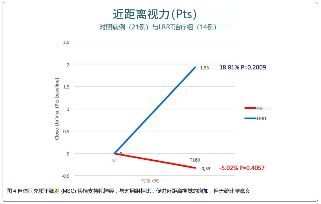 青光眼临床试验