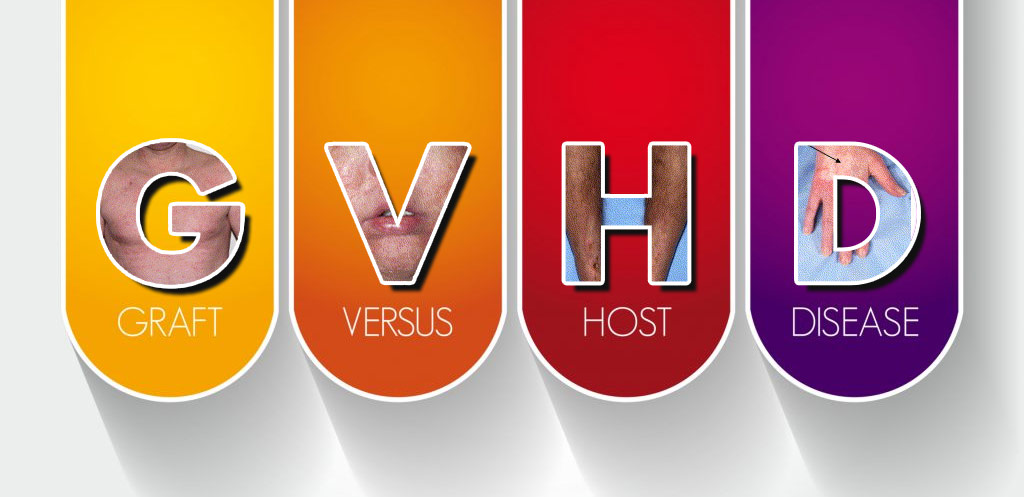 GVHD