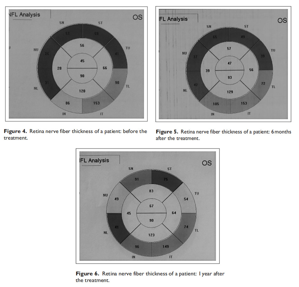 视神经萎缩临床试验