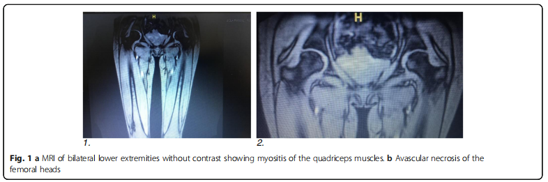 干细胞移植 干细胞移植