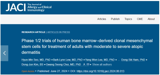 干细胞治疗特应性皮炎 干细胞治疗特应性皮炎