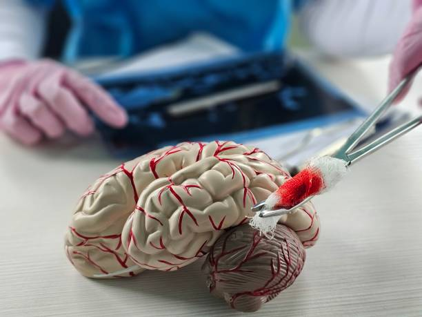 “开关现象”能解决？干细胞为帕金森病治疗带来新希望