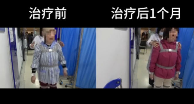 沈女士康复过程