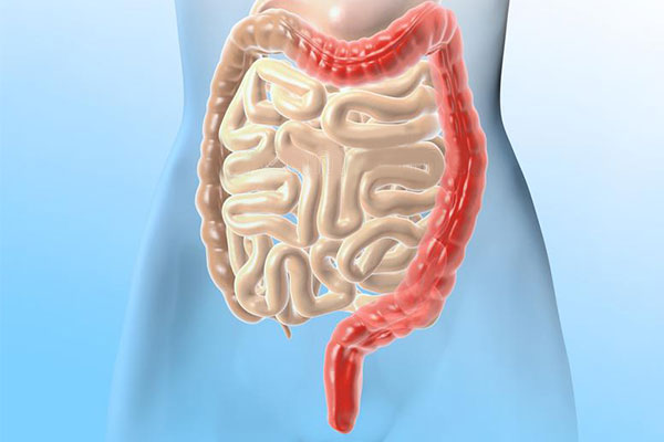 溃疡性结肠炎新希望：干细胞移植2个月缓解率达7成，4成患者实现粘膜愈合