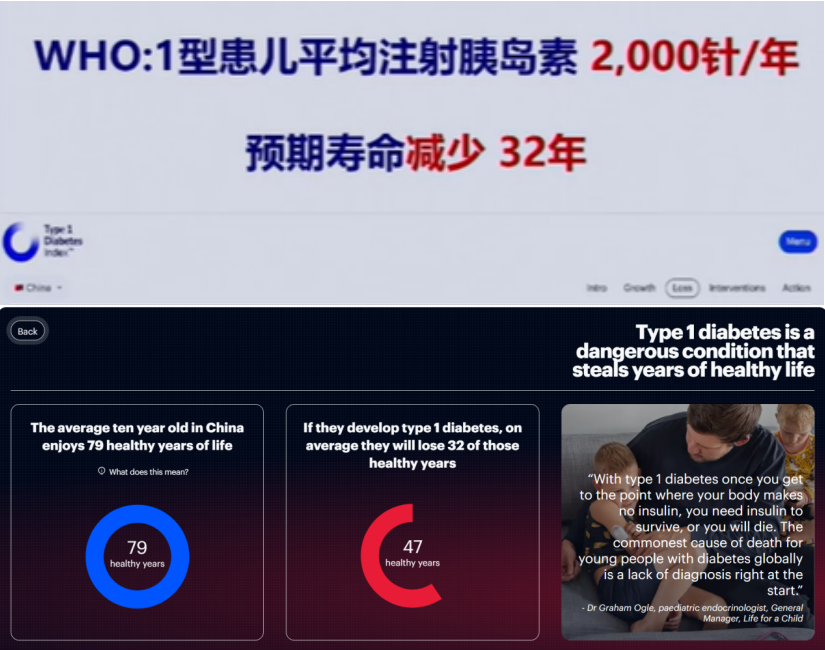 2025｜间充质干细胞疗法治疗1型糖尿病：现状与临床进展