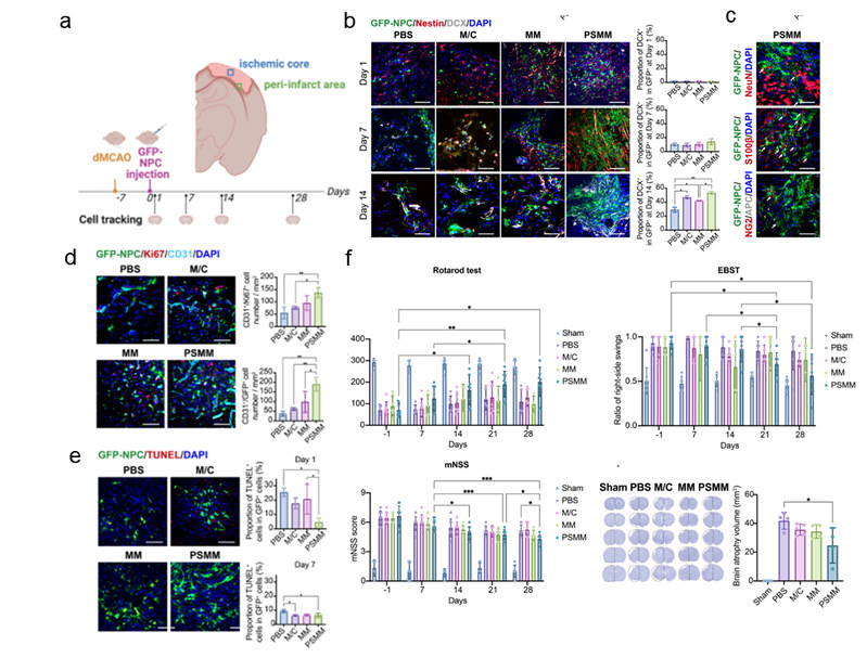 负载NPCs的PSMM-基质复合支架促进大鼠卒中后损伤修复 负载NPCs的PSMM-基质复合支架促进大鼠卒中后损伤修复